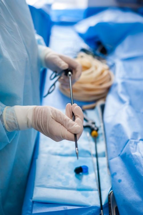 laparoskopiki riziki prostatektomi esoteriki